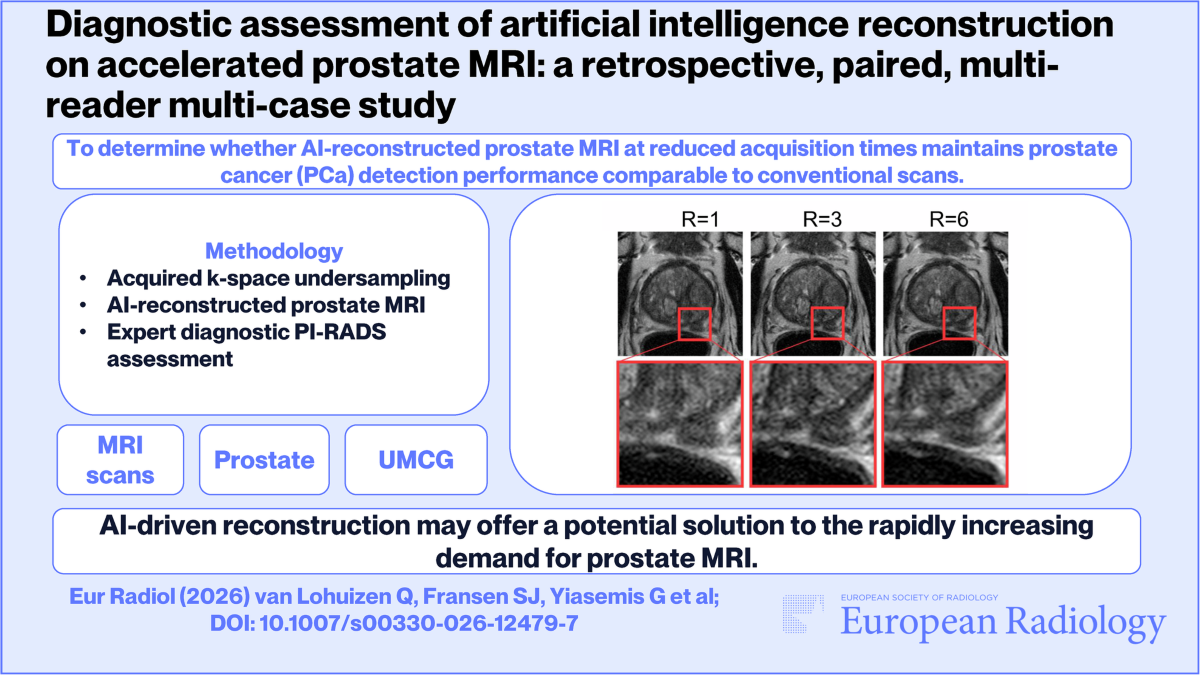 AI-reconstructed accelerated prostate MRI compared with conventional scans at R=1, R=3, and R=6