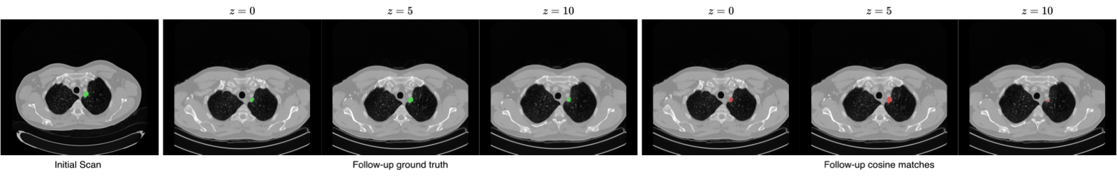 TAP-CT qualitative segmentation results on CT volumes